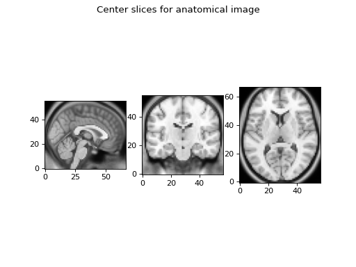 _images/neuro_radio_conventions-2_01.png